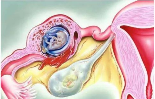 上海供精代怀：﻿怀孕一定要建档，不然会有很多麻烦事