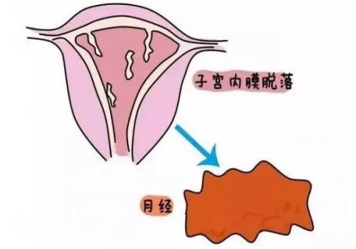 想了解宫腔镜手术？看看这些检查流程和详细步骤
